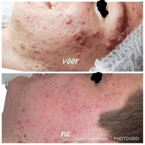 Huidspecialist Castricum image 4